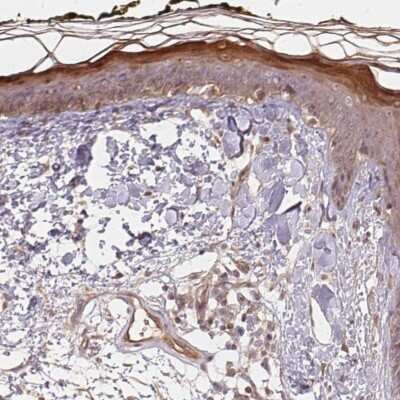 Immunohistochemistry-Paraffin: BLMH/Bleomycin Hydrolase Antibody [NBP1-88640]