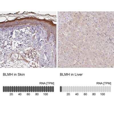 Immunohistochemistry-Paraffin: BLMH/Bleomycin Hydrolase Antibody [NBP1-88640]