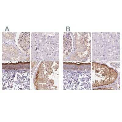 Immunohistochemistry-Paraffin: BLMH/Bleomycin Hydrolase Antibody [NBP1-88640]