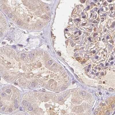 Immunohistochemistry-Paraffin: BLMH/Bleomycin Hydrolase Antibody [NBP1-88640]