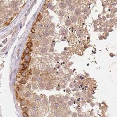 Immunohistochemistry-Paraffin: BLMH/Bleomycin Hydrolase Antibody [NBP1-88640]
