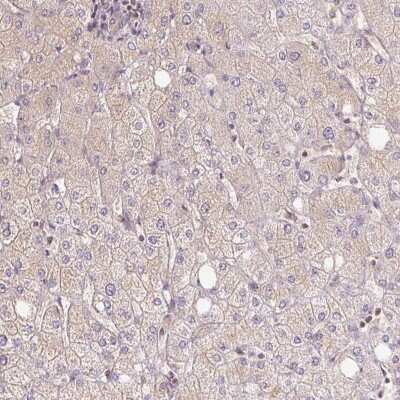 Immunohistochemistry-Paraffin: BLMH/Bleomycin Hydrolase Antibody [NBP2-39023]