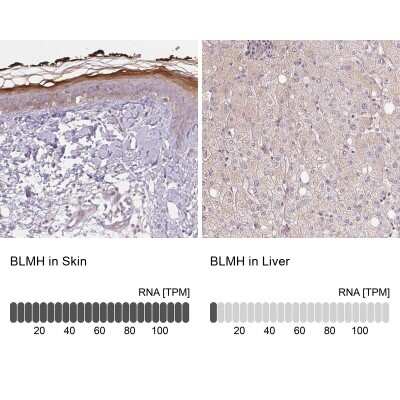 Immunohistochemistry-Paraffin: BLMH/Bleomycin Hydrolase Antibody [NBP2-39023]