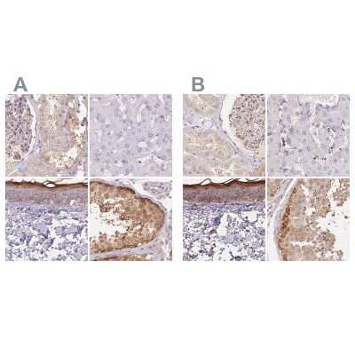 Immunohistochemistry-Paraffin: BLMH/Bleomycin Hydrolase Antibody [NBP2-39023]
