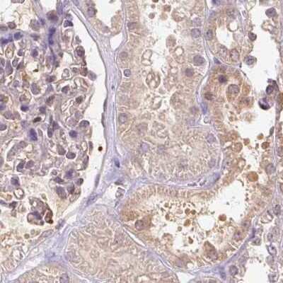 Immunohistochemistry-Paraffin: BLMH/Bleomycin Hydrolase Antibody [NBP2-39023]