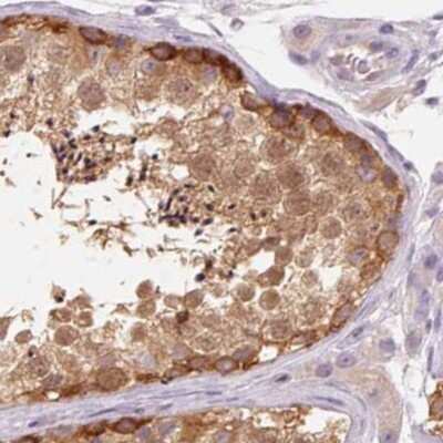 Immunohistochemistry-Paraffin: BLMH/Bleomycin Hydrolase Antibody [NBP2-39023]