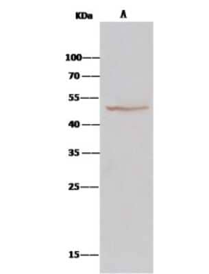 Immunoprecipitation: BLMH/Bleomycin Hydrolase Antibody [NBP2-99780]