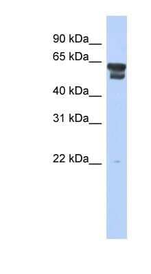 Western Blot: BLMH/Bleomycin Hydrolase Antibody [NBP1-55141]