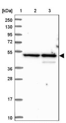 Western Blot: BLMH/Bleomycin Hydrolase Antibody [NBP1-88640]