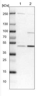 Western Blot: BLMH/Bleomycin Hydrolase Antibody [NBP1-88640]