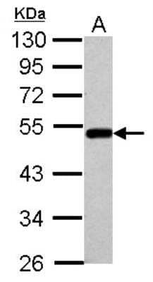 Western Blot: BLMH/Bleomycin Hydrolase Antibody [NBP2-15592]