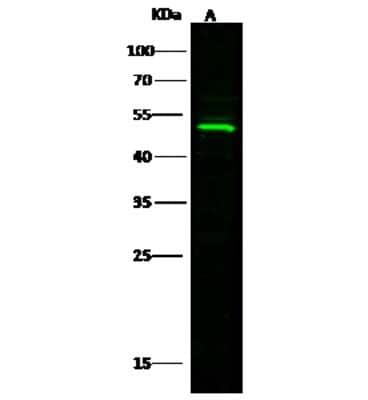 Western Blot: BLMH/Bleomycin Hydrolase Antibody [NBP2-98334]