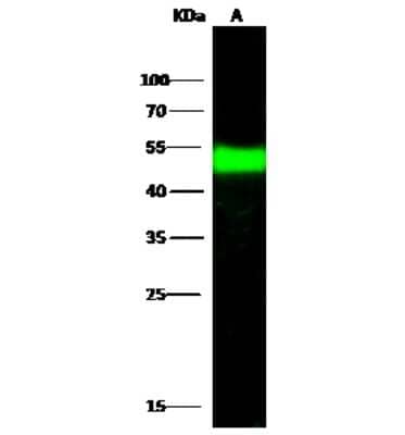 Western Blot: BLMH/Bleomycin Hydrolase Antibody [NBP2-99780]