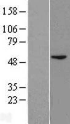 Western Blot: BLMH/Bleomycin Hydrolase Overexpression Lysate [NBL1-07990]