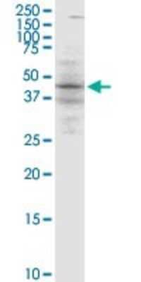 Western Blot: BLNK Antibody (1D7) [H00029760-M04]