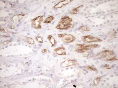 Immunohistochemistry: BLNK Antibody (OTI4C9) [NBP2-46577]