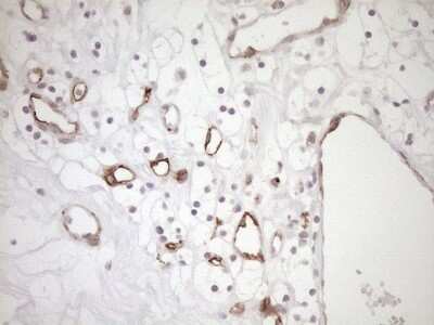 Immunohistochemistry: BLNK Antibody (OTI4C9) [NBP2-46577]