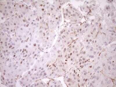Immunohistochemistry: BLNK Antibody (OTI4C9) [NBP2-46577]