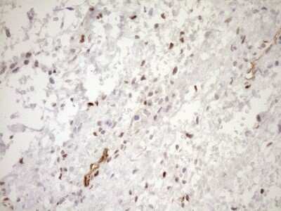 Immunohistochemistry: BLNK Antibody (OTI4C9) [NBP2-46577]
