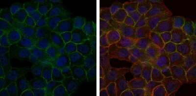 Immunocytochemistry/ Immunofluorescence: BLNK Antibody (5G9) - BSA Free [NBP2-37585]
