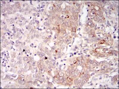 Immunohistochemistry-Paraffin: BLNK Antibody (5G9) - BSA Free [NBP2-37585]