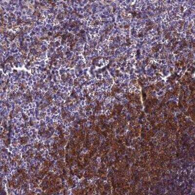 Immunohistochemistry: BLNK Antibody [NBP2-14356]
