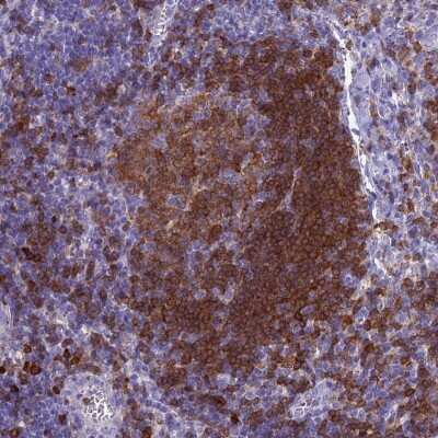 Immunohistochemistry-Paraffin: BLNK Antibody [NBP2-14355]