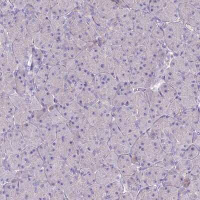 Immunohistochemistry-Paraffin: BLNK Antibody [NBP2-14355]