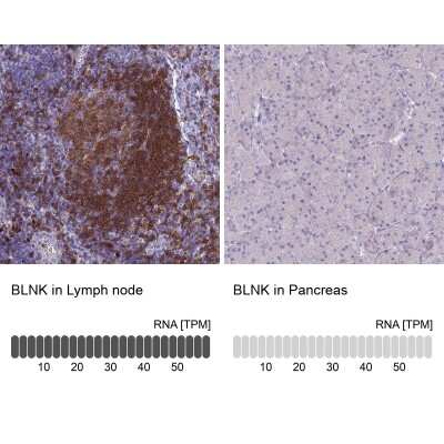 Immunohistochemistry-Paraffin: BLNK Antibody [NBP2-14355]