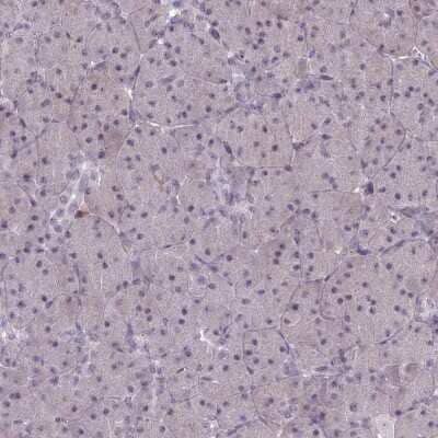 Immunohistochemistry-Paraffin: BLNK Antibody [NBP2-14356]