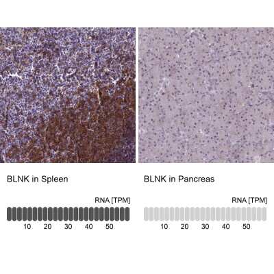 Immunohistochemistry-Paraffin: BLNK Antibody [NBP2-14356]