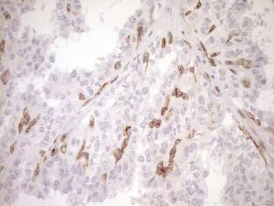 Immunohistochemistry: BLNK Antibody (OTI4C9) - Azide and BSA Free [NBP2-71855]