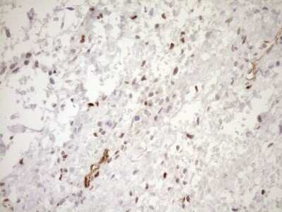 Immunohistochemistry: BLNK Antibody (OTI4C9) - Azide and BSA Free [NBP2-71855]