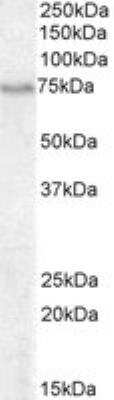 Western Blot: BLNK Antibody [NB100-804]