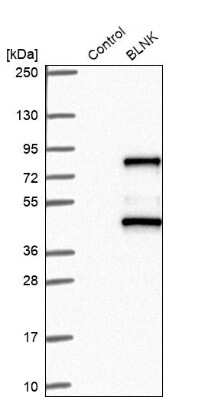 Western Blot: BLNK Antibody [NBP2-14355]