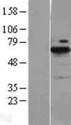 Western Blot: BLNK Overexpression Lysate [NBL1-07991]