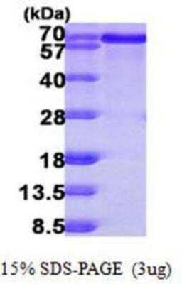 SDS-PAGE: Recombinant Human BLNK His Protein [NBP1-50993]