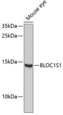 Western Blot: BLOC1S1 AntibodyBSA Free [NBP2-92484]