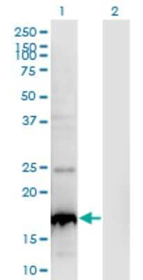 Western Blot: BLOC1S2 Antibody (8C10) [H00282991-M01]