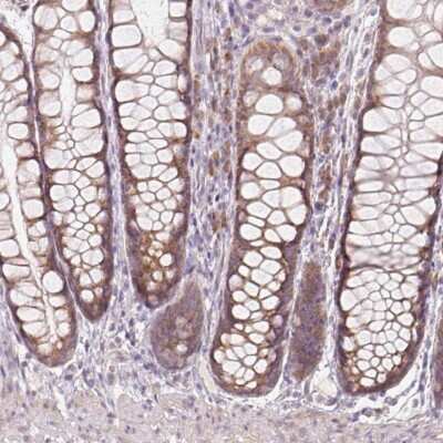 Immunohistochemistry: BLOC1S2 Antibody [NBP2-49162]