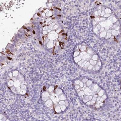 Immunohistochemistry-Paraffin: BLOC1S2 Antibody [NBP2-14357]