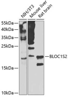 Western Blot: BLOC1S2 AntibodyBSA Free [NBP3-05039]