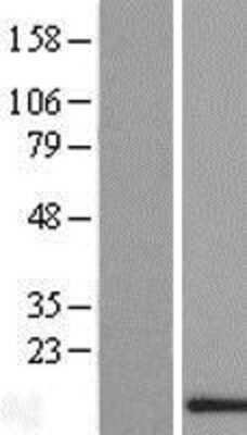 Western Blot: BLOC1S2 Overexpression Lysate [NBL1-07992]