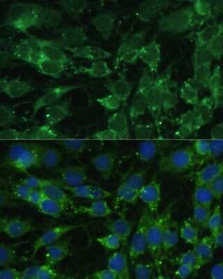 Immunocytochemistry/ Immunofluorescence: BLOS3 Antibody - BSA Free [NBP3-03343]