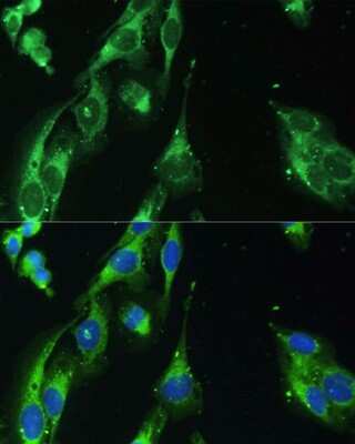 Immunocytochemistry/ Immunofluorescence: BLOS3 Antibody - BSA Free [NBP3-03343]