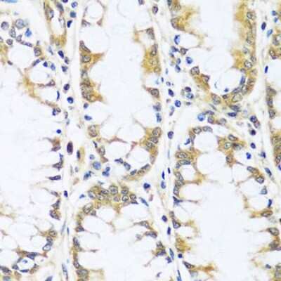 Immunohistochemistry-Paraffin: BLOS3 Antibody - BSA Free [NBP3-03343]