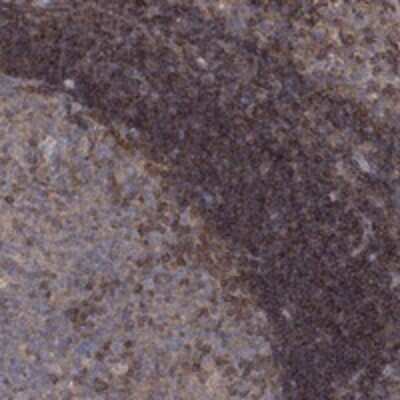 Immunohistochemistry-Paraffin: BLOS3 Antibody [NBP3-17346]