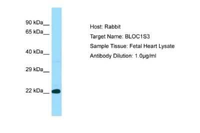 Western Blot: BLOS3 Antibody [NBP1-98303]