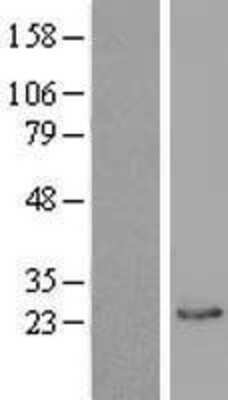 Western Blot: Biliverdin Reductase B/BLVRB Overexpression Lysate [NBL1-07994]