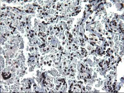 Immunohistochemistry: BMAL1 Antibody (OTI1H6) [NBP2-46544]